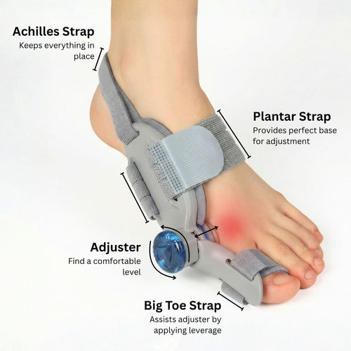 GentleGap™ Bunion Corrector